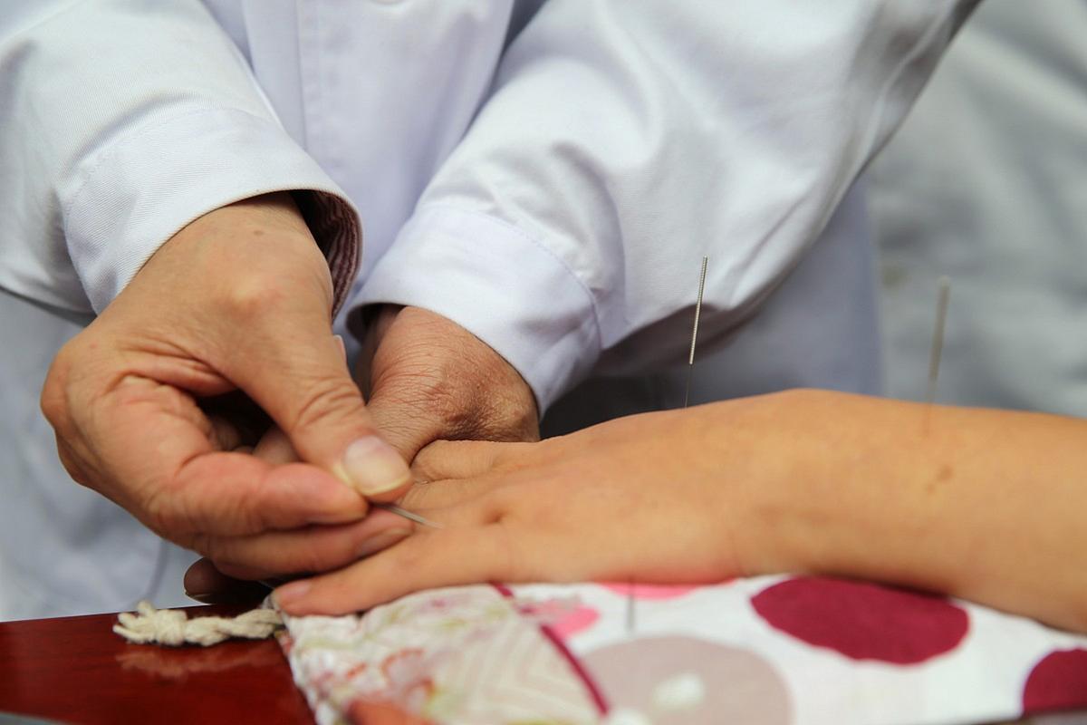 类风湿性关节炎针灸治疗