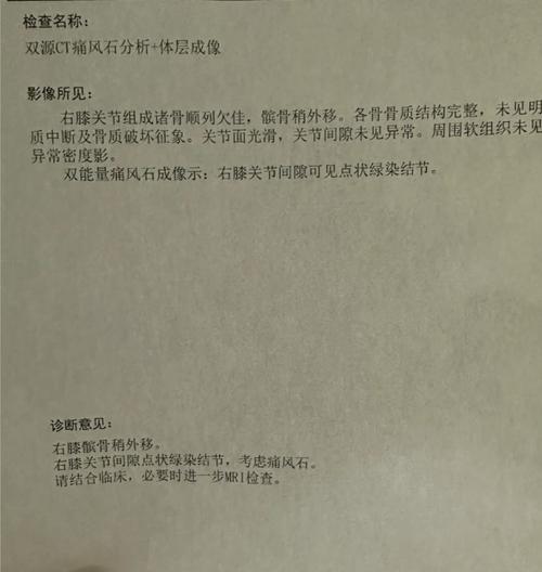 类风湿性关节炎辅助检查