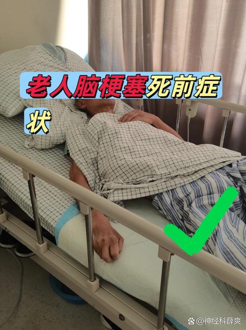 脑梗昏睡20多天醒来