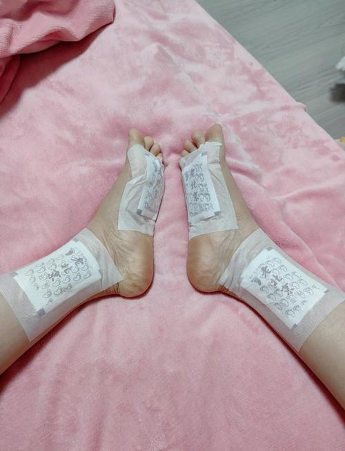 脑梗病人脚底针灸理疗