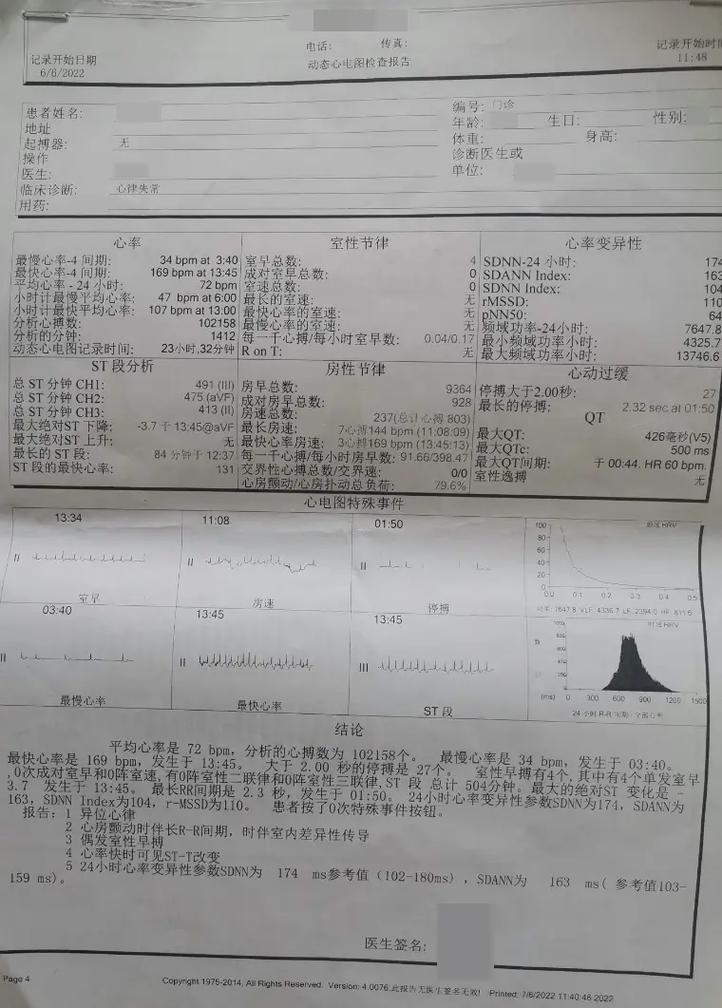 风湿性心脏病做什么检查