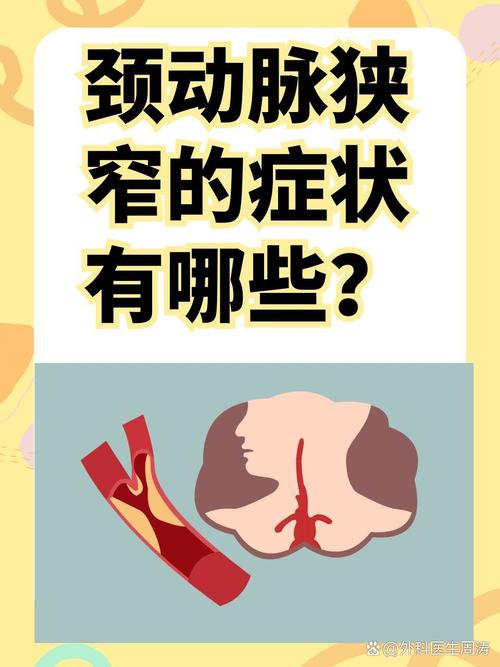 颈内动脉狭窄急性脑梗