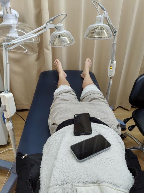 类风湿关节炎的针灸治疗