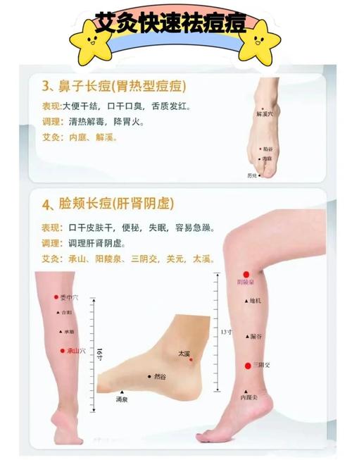 哪个穴位治疗皮肤最好