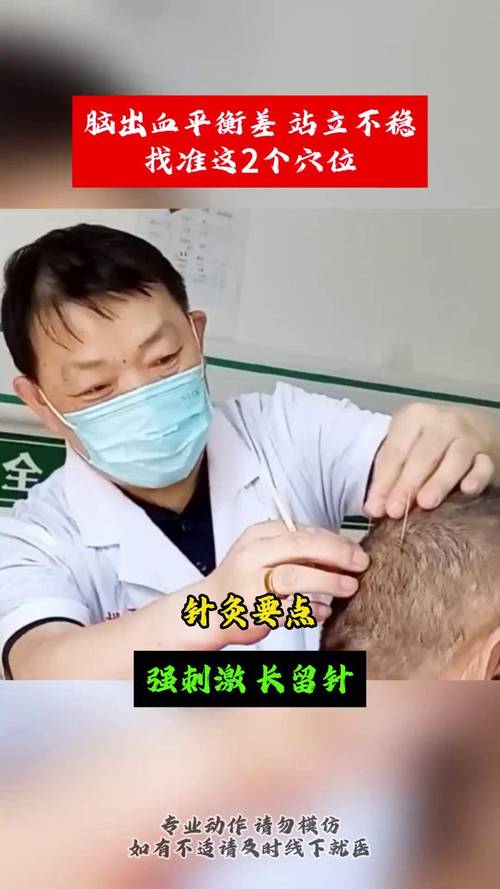 脑梗病人针灸需要多久