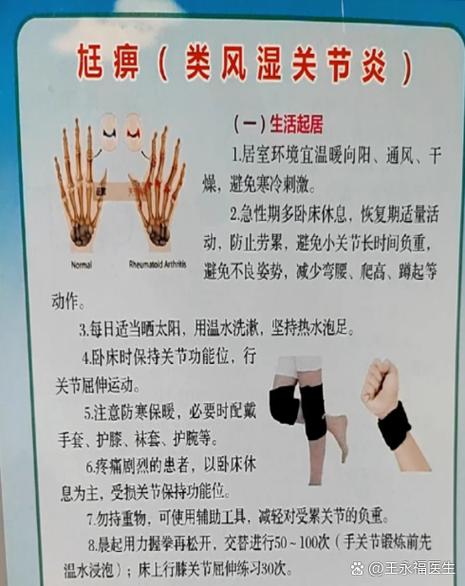 类风湿性关节炎能治好么