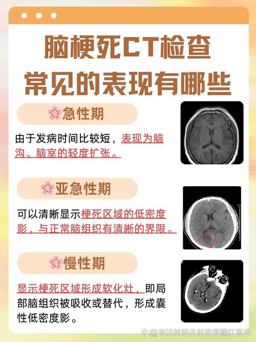 诊断脑梗要做哪些检查