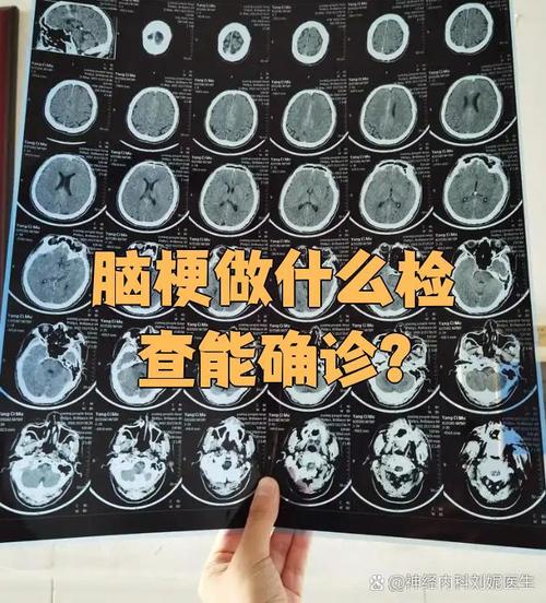 诊断脑梗要做哪些检查