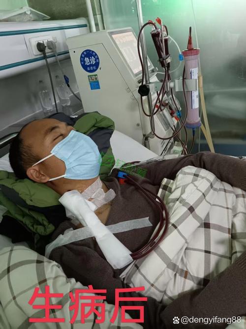 春秋换季输液治疗脑梗