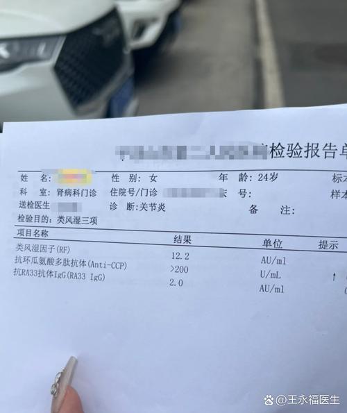 类风湿早期能检查出来吗