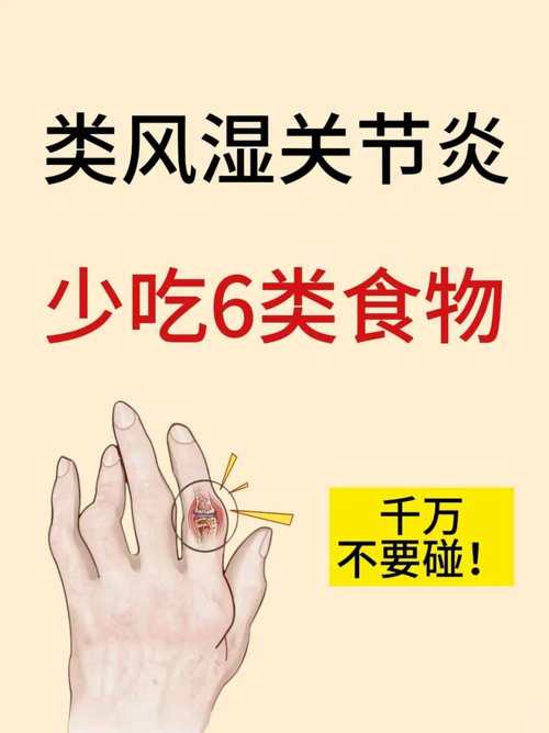 类风湿关节炎应该吃什么