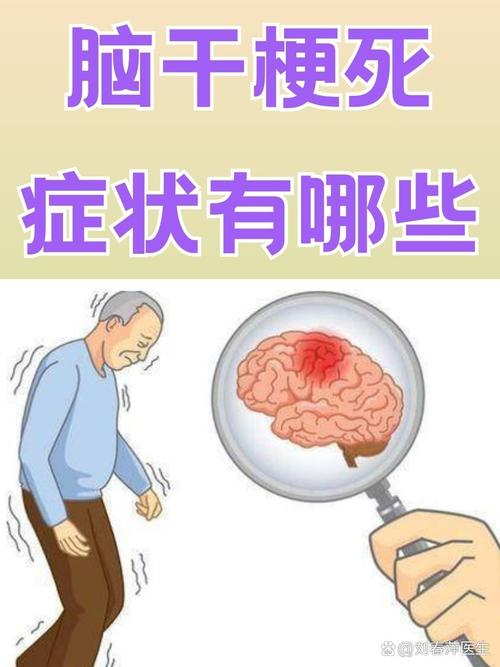 脑梗 脑袋疼 想吐