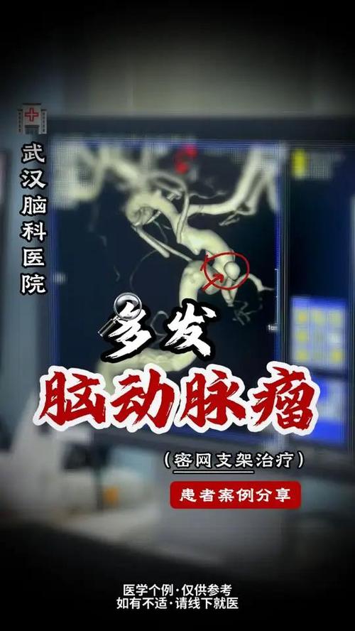 脑梗复查要做cta吗