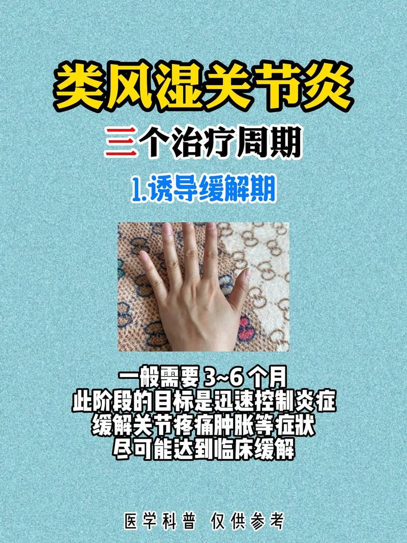 类风湿怎么样治疗比较好