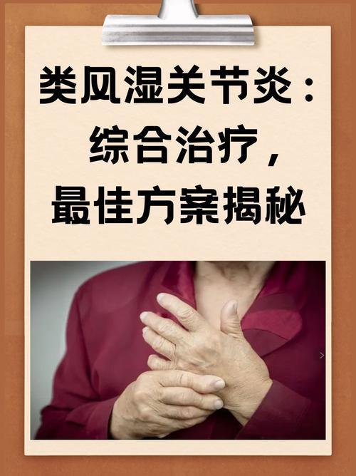 类风湿怎么样治疗比较好