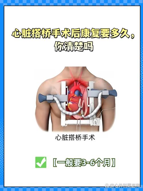 心脏搭桥手术诱发脑梗