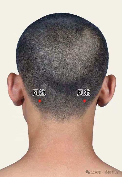 脑梗面瘫针刺什么学位