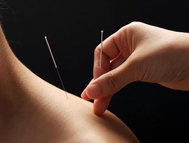 针灸穴位男性真人挂图