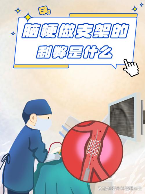 脑梗能做介入 治疗吗