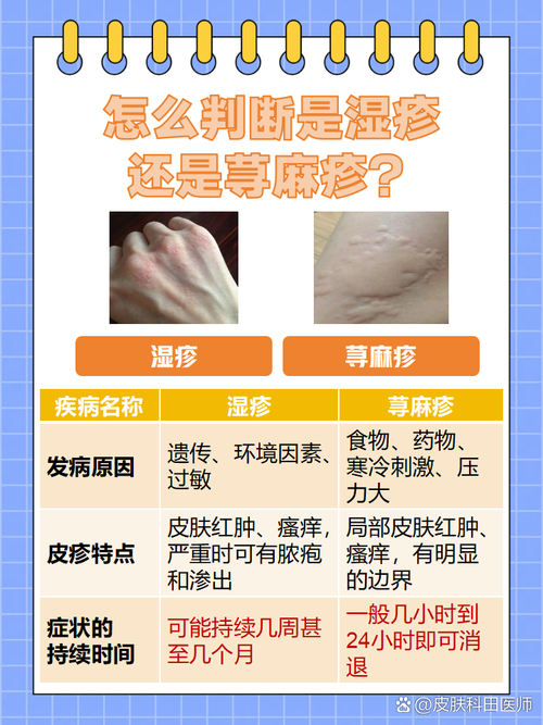 风湿疹是什么原因引起的