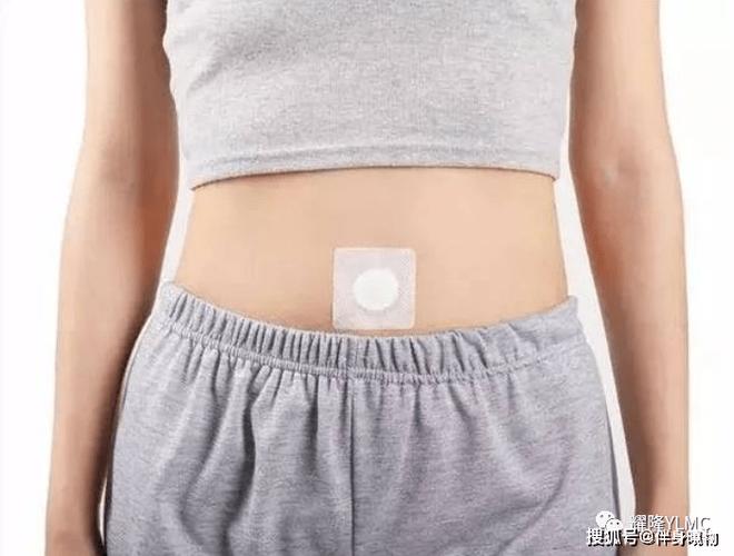 修正腹泻腹痛穴位敷贴