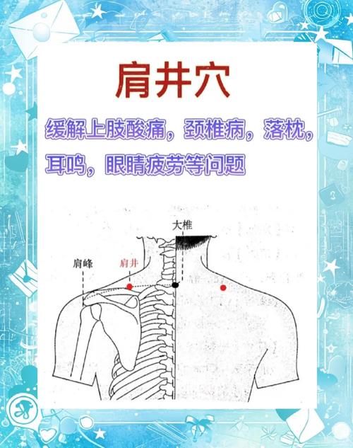 治疗肩周炎取哪些穴位