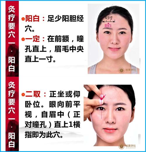 艾灸痘痘面部哪个穴位