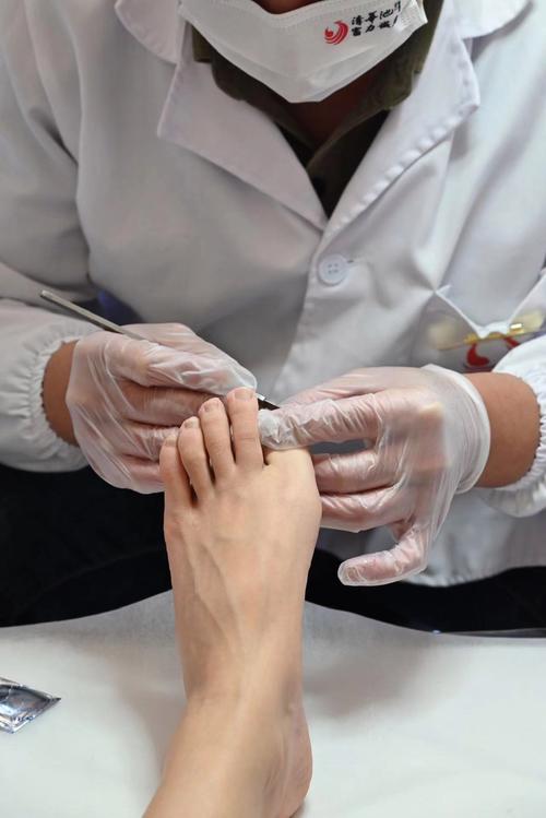 美女体验脚底穴位针灸