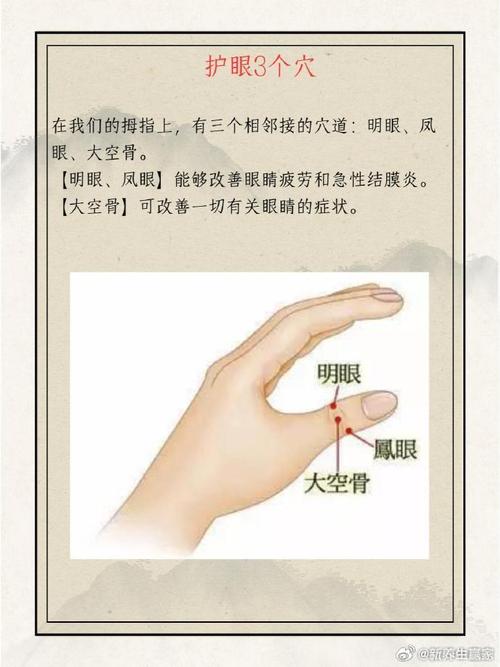 按摩穴位可以治疗近视