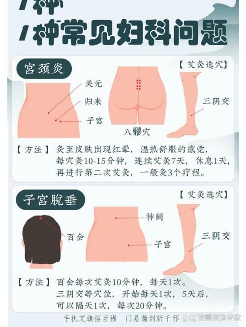 子宫松弛艾灸什么穴位