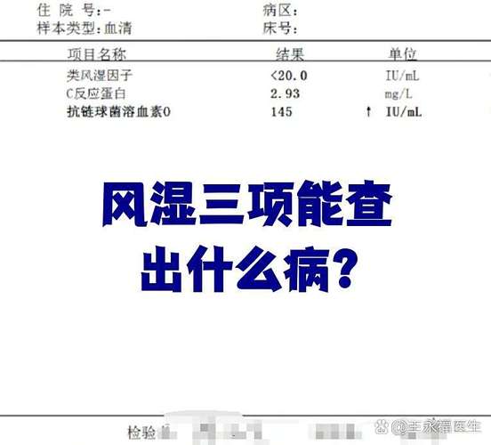 风湿检查 iga增加