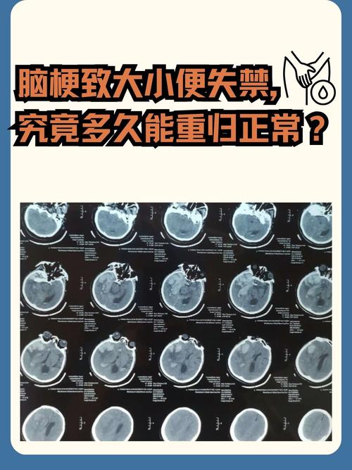 脑梗病人突然大便失禁