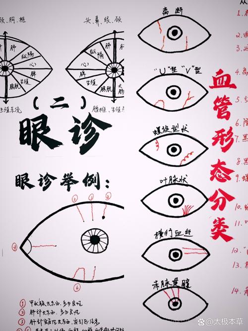 脑梗瞳孔神志观察变化