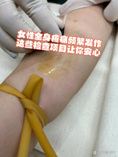 风湿免疫 抽血 月经