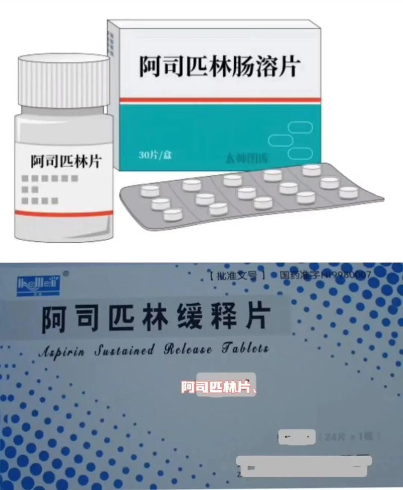 脑梗吃不吃阿司匹林吗