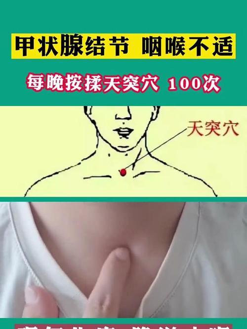 甲状腺结节 穴位艾灸