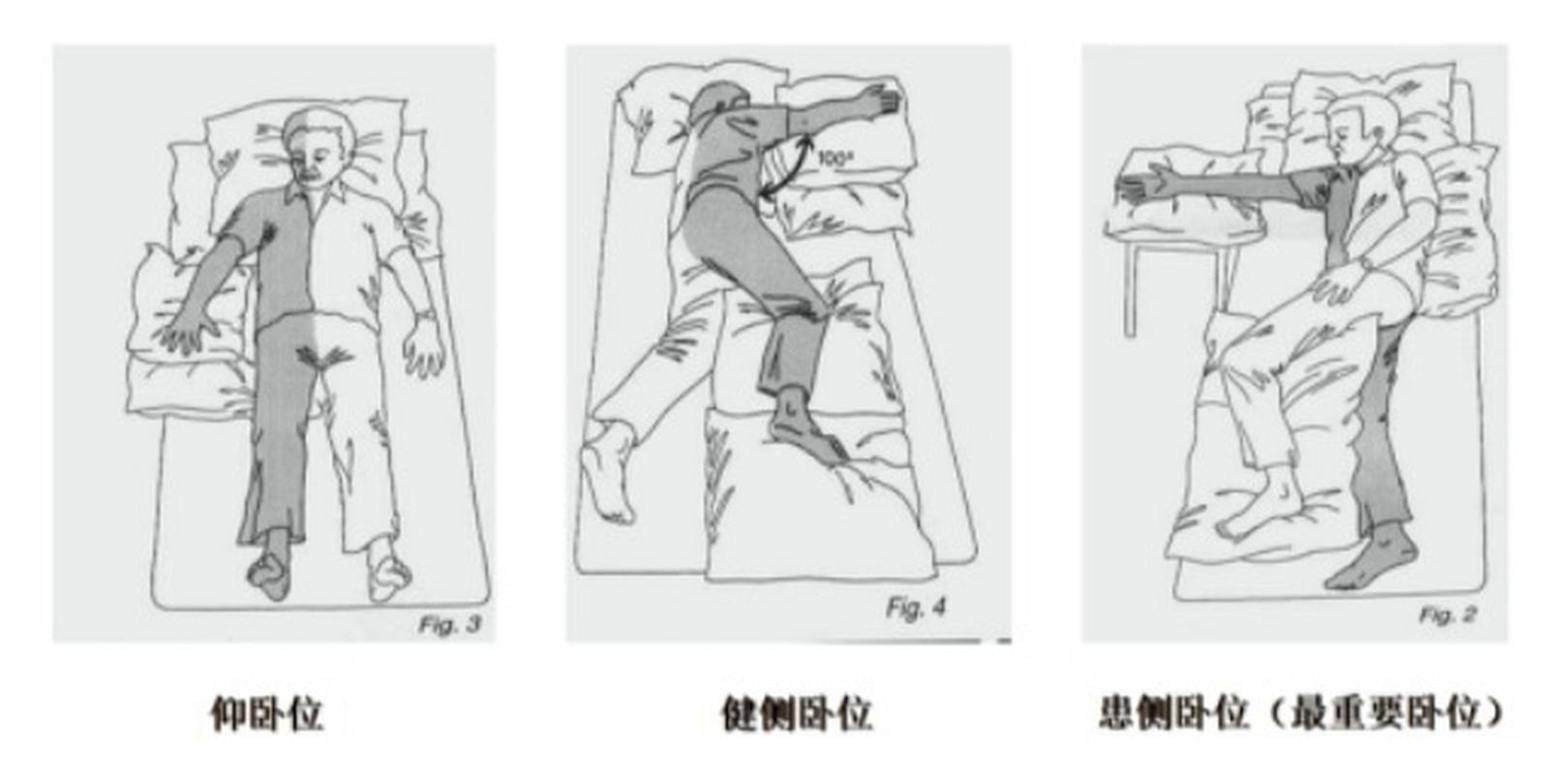 脑梗偏瘫病人怎么护理