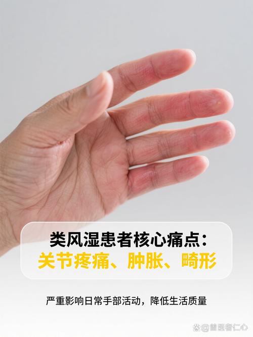 类风湿因子41.38