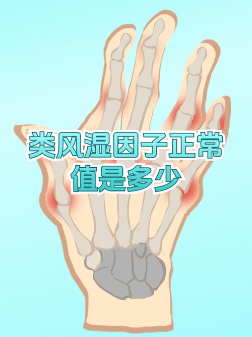 类风湿因子 9.19