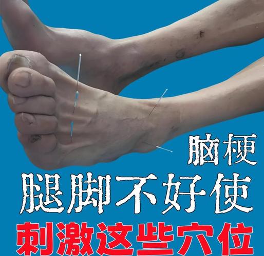 脑梗无法说话针灸哪里