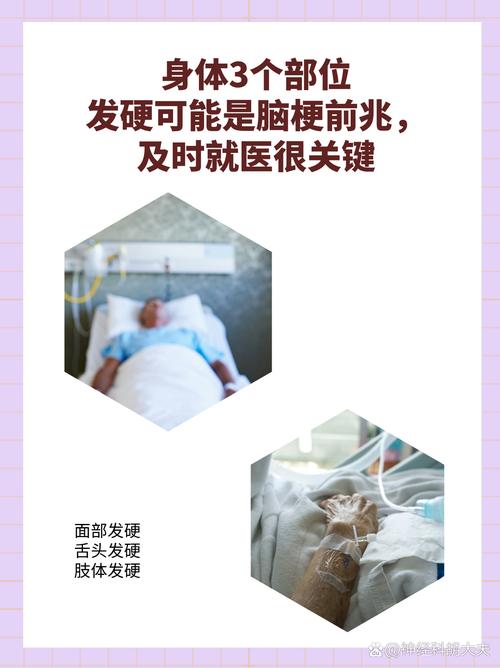 全麻苏醒后 脑梗风险