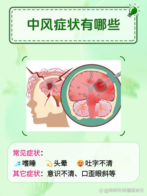 脑梗中风急性发作症状