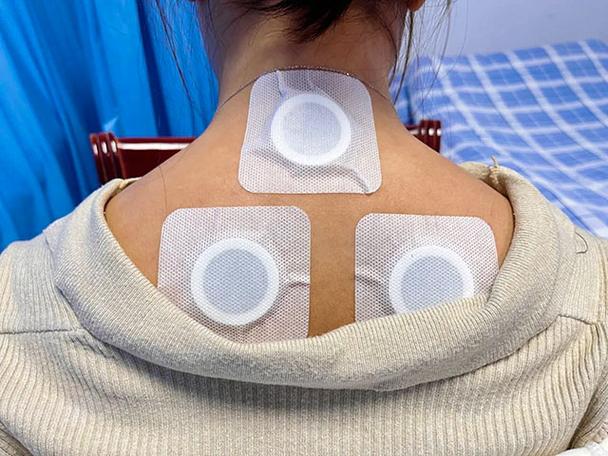 穴位贴敷将药物和穴位