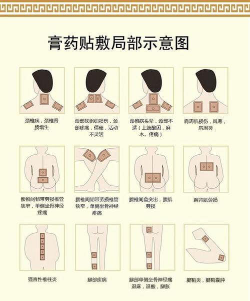 穴位贴不贴穴位可以不