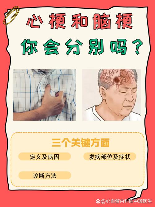 通心络预防脑梗心梗吗