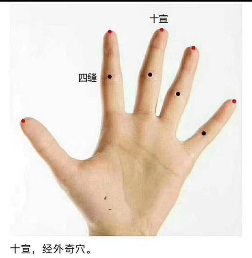 穴位十十宣穴位位置图