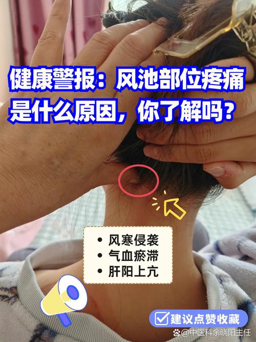 穴位风池穴位疼呀回事