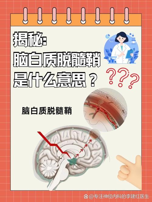 脑自质脱髓就是脑梗吗