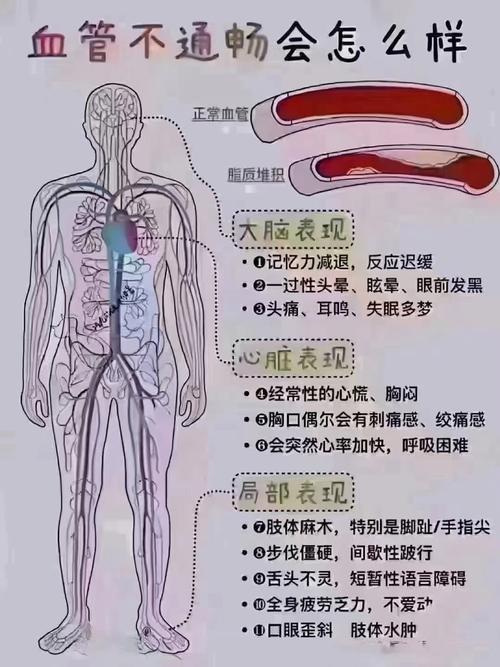 心梗和脑梗是怎么回事