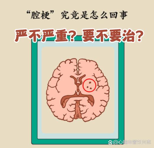 脑梗的腔梗是什么意思